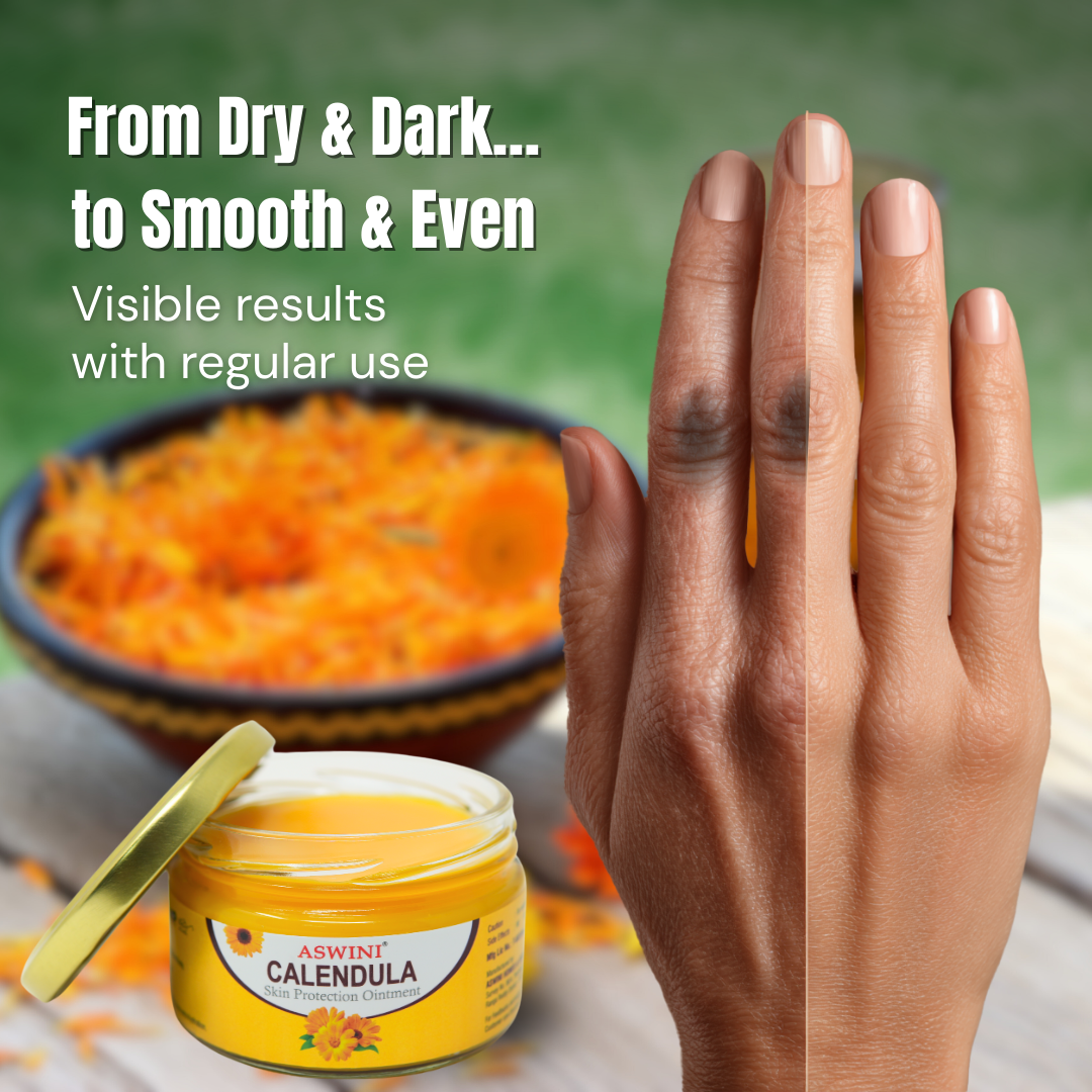 Aswini Calendula Skin Ointment